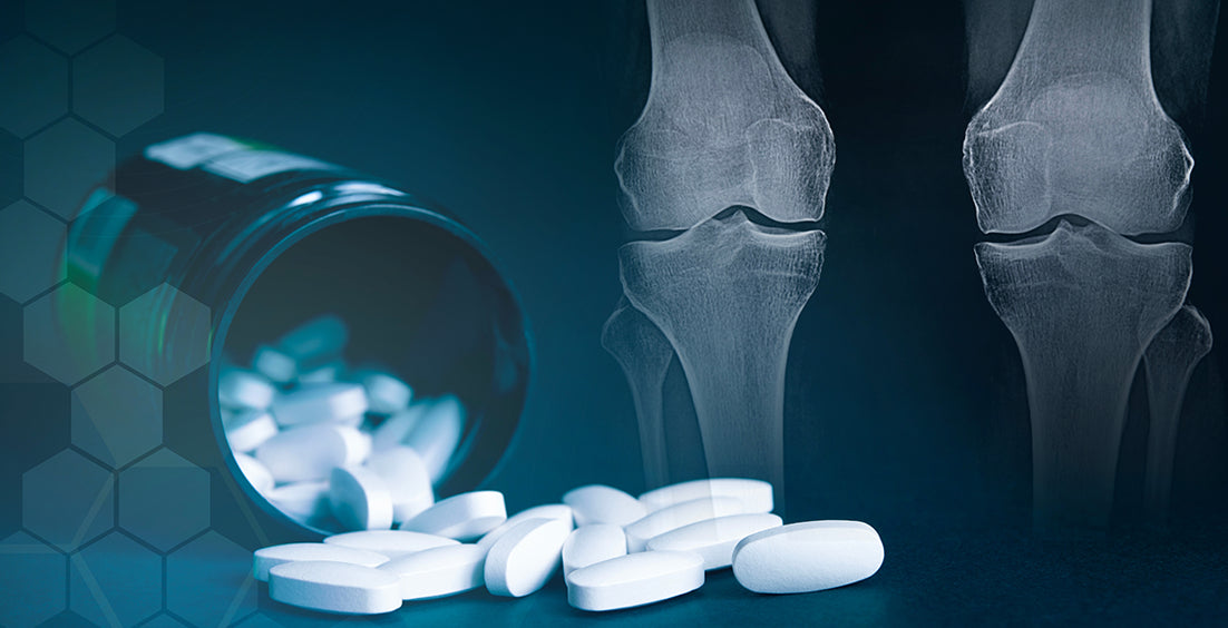 Best Joint Supplements for Pain Relief