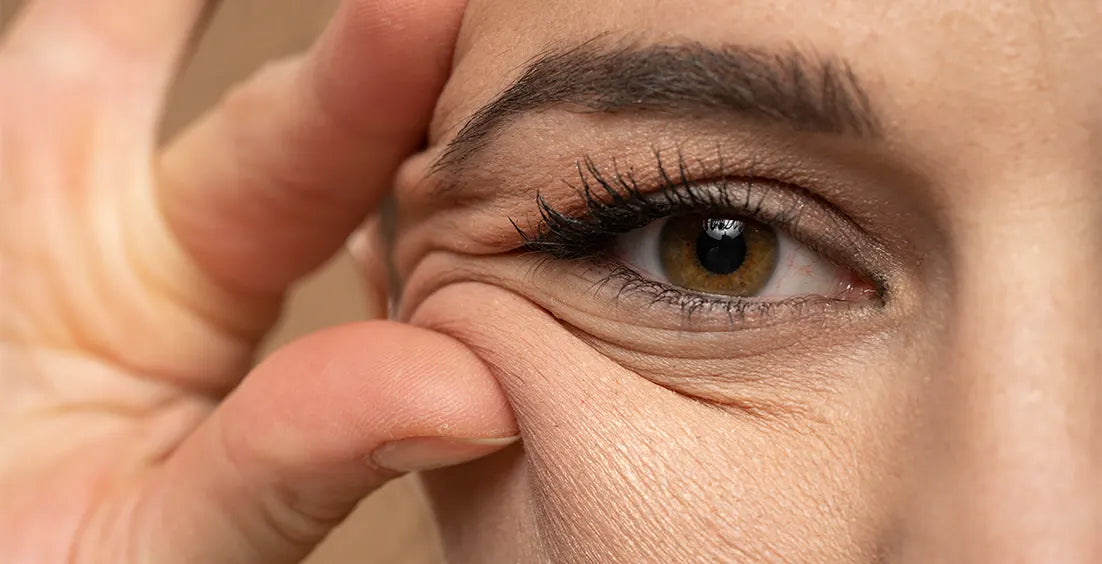 Collagen Deficiency Symptoms, Causes and Treatment